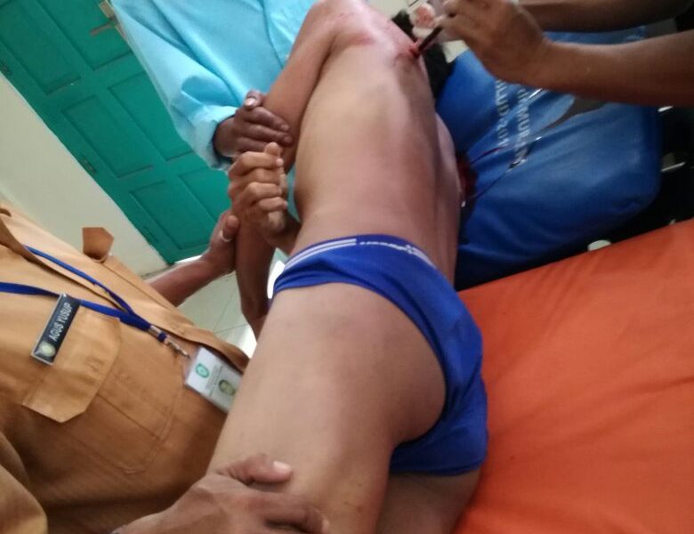 Dipicu Perselingkuhan, Pria Ini Tewas Dibacok