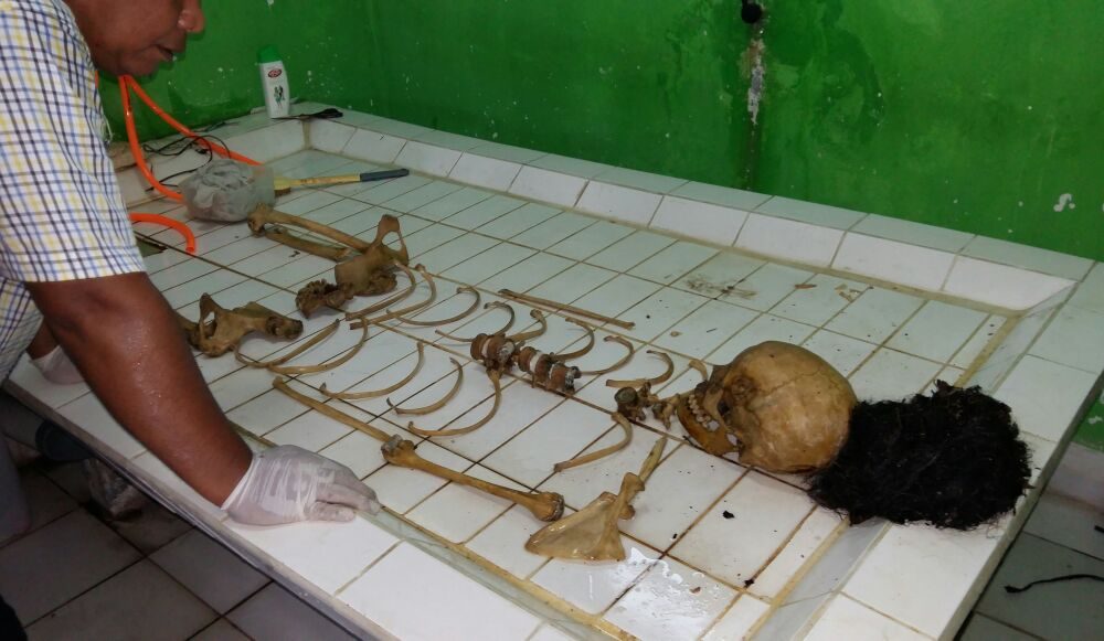 Astaga!! Tengkorak di Aruta Ini, Wanita Muda Diduga Korban Pembunuhan