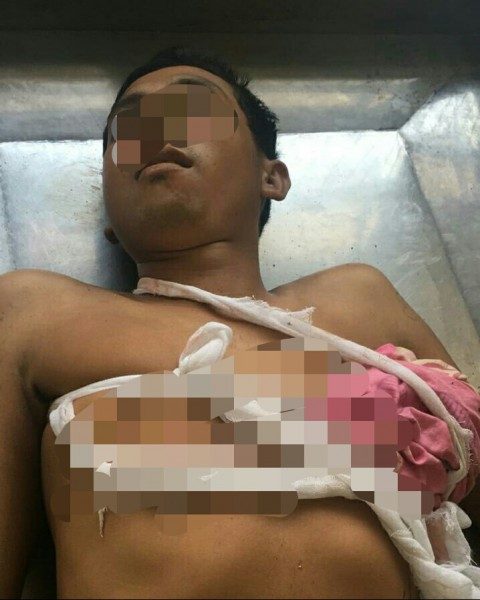Karyawan PT IFP Tewas Ditusuk