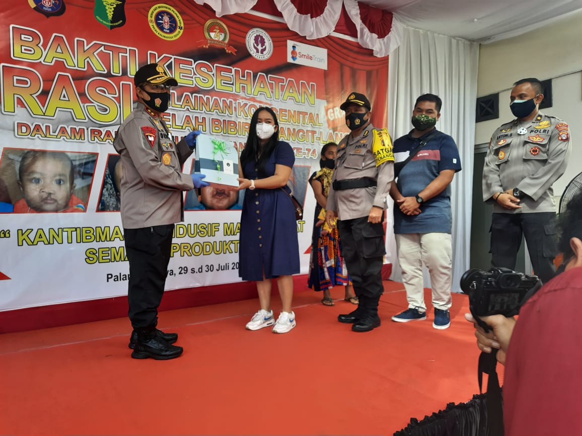 Polda Kalteng Gelar Bakti Sosial Operasi Bibir Sumbing Gratis