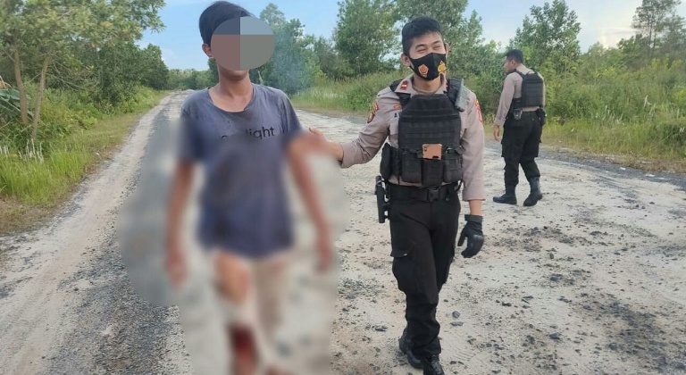 Jatuh Saat Ngebut, Seorang Remaja Luka Parah 